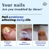 101 Pcs Ingrown Toenail Treatment Set, Clear Ingrown Toenail Corrector