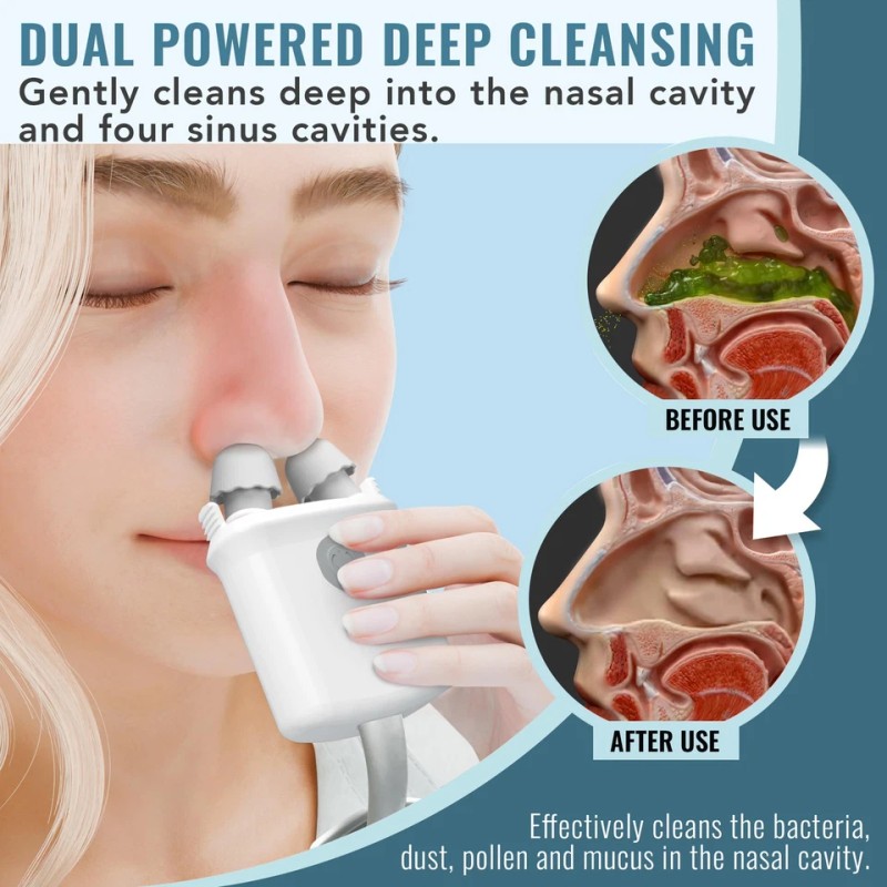 NASALFRESH MD - Dual Powered Nasal Irrigation System Nasal Rinse