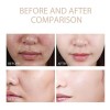 Melaxina Coreana Shot Peel Rice Dr. Exfoliating Essence
