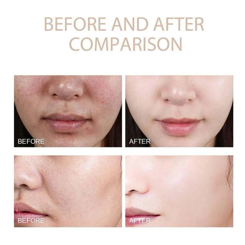 Melaxina Coreana Shot Peel Rice Dr. Exfoliating Essence