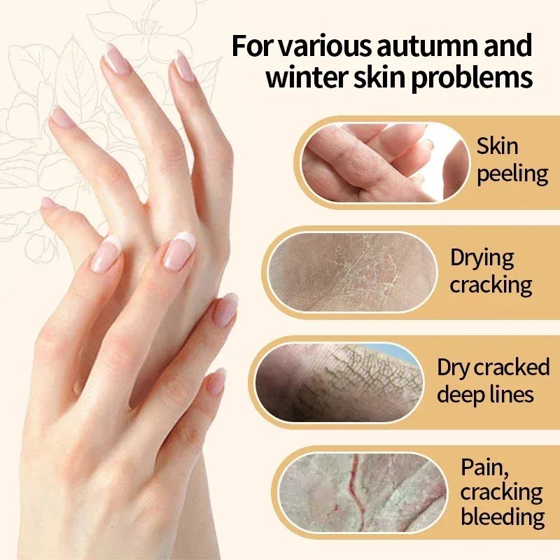 Crema Ácida Antiarrugas Kojic Nourish Suave Skin