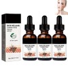 GFOUK Melanin Correcting Facial Serum,Dark Spot Face Serum,Bright Skin Dark