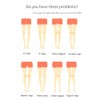 Leg Positioning Corrector Strap, Leg Correction Belt, Set of 3