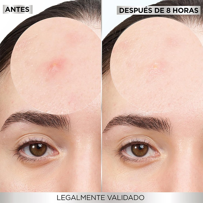 Garnier Pimple Patch Invisible, Parches Hidrocoloides Para Acné, Reduce Imperfecciones