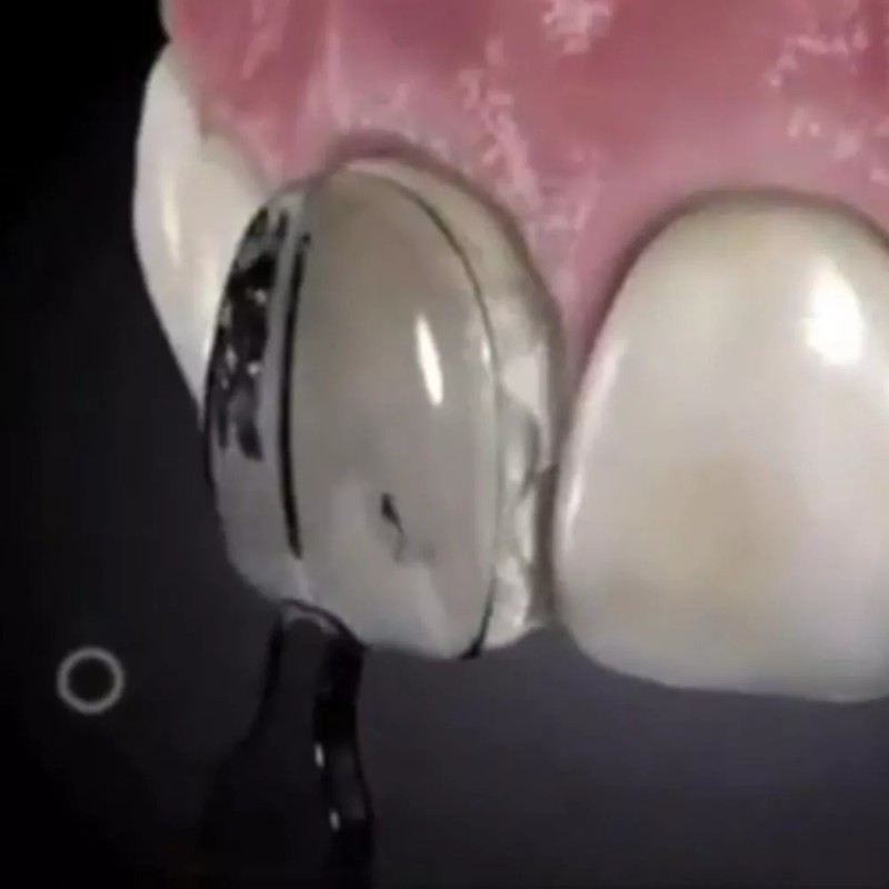 generic A 32 Piezas/juego De Molde De Barniz Dental