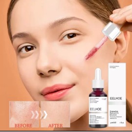 Eelhoe Granactive Retinoid 2% Emulsión  30ml