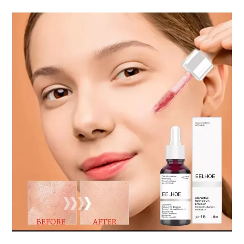 Eelhoe Granactive Retinoid 2% Emulsión 30ml