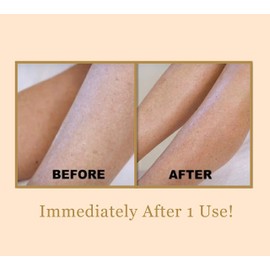 Bee Stunning DIAMONDBUFF Microderm Exfoliation Tool - At Home Professional BODY Diamond Crystal Microdermabrasion for Glowing Youthful Skin - Soften Crepey Skin, Fine Lines, & Improve Rough Texture!