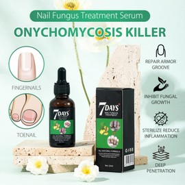 Suero para el crecimiento de las uñas, suero reparador de extracto de jengibre, suero para el tratamiento de esencia fortalecedor y crecimiento de las uñas para la belleza de las uñas brillantes, 30ml