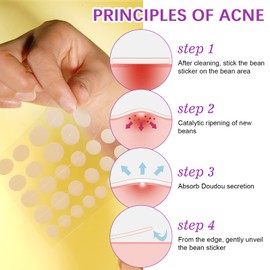 192 Stück Patches Pickel, Pickel, Pimple Patch unsichtbare Pickel Hydrokolloid Akne Pimple Behandlung Anti-Akne und Anti-Unvollkommenheiten Tag Gesicht können Akne schnell loswerden