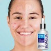 Bioaqua Serum Pure Skin Retira Acne Y Espinillas Regenera