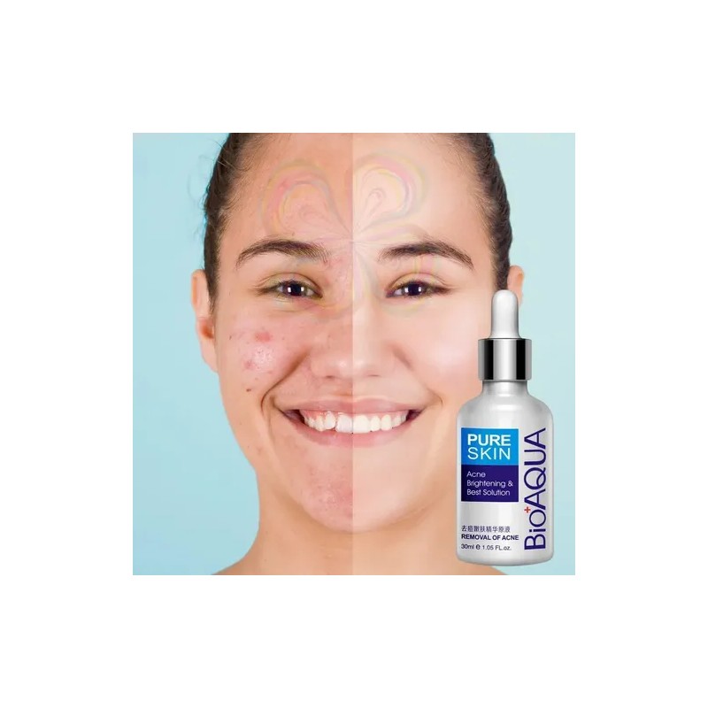 Bioaqua Serum Pure Skin Retira Acne Y Espinillas Regenera