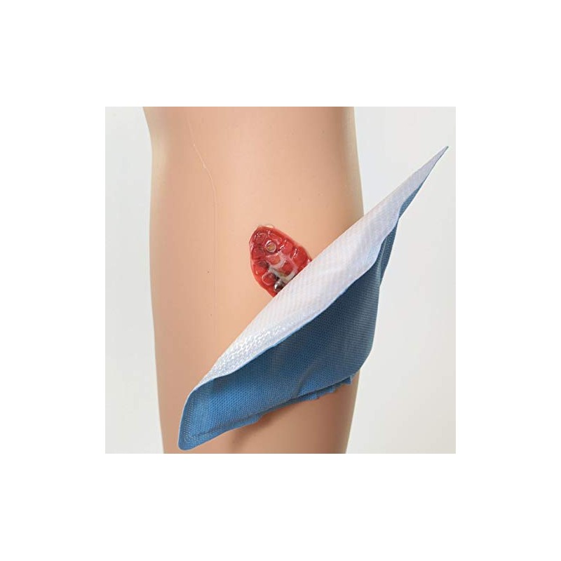 Sorbex Super Absorbent Dressing Pad for Moderate to Heavy Exuding