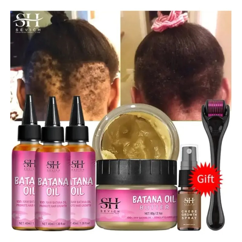 Aceite Para El Cabello Batana Pure 100% Growth Batana Africa