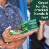 Bag Balm Pomada para bálsamo de bolsa, 1 onza, Paquete