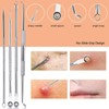 Blackhead Remover Blackhead Remover Blackhead Remover Blackhead Tool Facial Cleansing