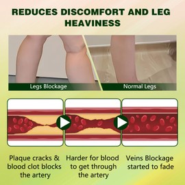 100G FluidEase Leg Therapy Edema Cream, Balm for Swollen Legs, Edema Relief for Legs and Feet, Natural Herbal Massage Cream, for All Skin Types