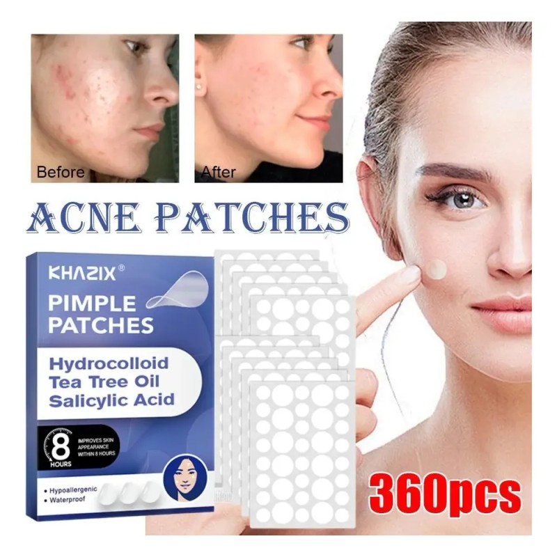 360pcs Breathable Circle Acne Patch Skincare Rapid