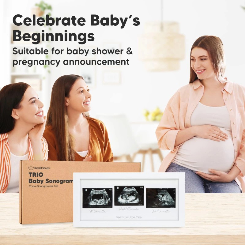 Keababies Baby Sonogram Picture Frames - Trio Ultrasound Pic
