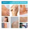Advanced Silicone Scar Treatment Sheets for OLD, NEW Scars, Surgery,