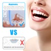4 Pcs Aligner Removal Tool Retainer Remover Tool Kits Invisible