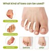 Bukihome 44-Pack Foam Toe Separators Soft & Breathable Toe Spacers
