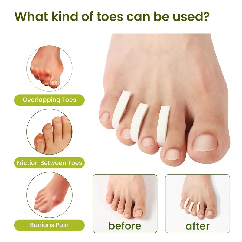 Bukihome 44-Pack Foam Toe Separators Soft & Breathable Toe Spacers