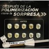 WELLSPRING |Resina Compuesta Unicromática 4g para Restauraciones Dentales, Alta Estética,