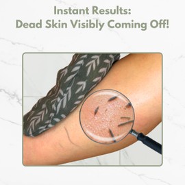 Ulili Premium Exfoliating Glove | Exfoliating Mitt and Kessa for Shower and Bath Use | Hammam Body Scrubber for Deep Cleansing and Skin Renewal | Made from 100% Viscose Fiber