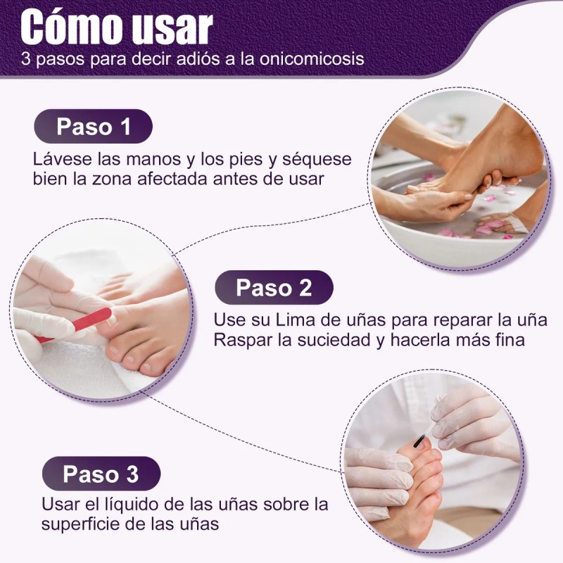 Fungicida Para Uñas Para Uñas Dañadas,rotas Y Decoloradas