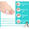 Byehambuni Hammer Toe Straightener, 6 Pack Hammer Toe Corrector for