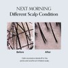 GROWUS [GROWUS]Damage Therapy Scalp Scaling Ampoule 50ml
