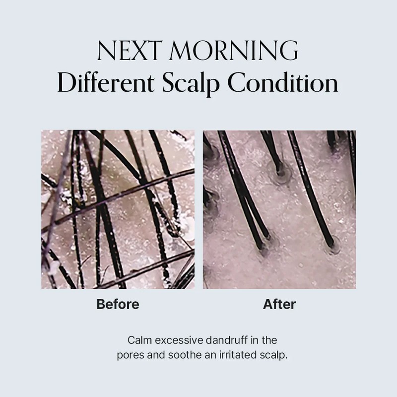 GROWUS [GROWUS]Damage Therapy Scalp Scaling Ampoule 50ml
