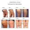 Gel Crema Perder Peso Abdomen Grasa Adelgazar Celulitis Neutra