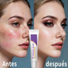 Suero Facial con Acido Azelaico al 15%, Crema Hidratante Calma la Piel, Reduce Imperfecciones y Unifica el Tono, Tratamiento Facial Suave para Todo Tipo de Piel (2 Unidades)