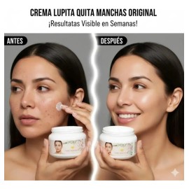 Crema Lupita 50ml Anti Manchas Acne Facial Axila Todo Tipo Piel Día Noche