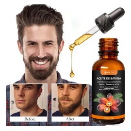 Aceite Batana 100% Natural Para Crecimiento Y Cuidado Barba