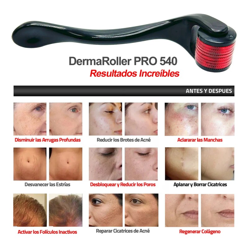 0.5mm Dermaroller Pro Titanio + Aplicador Para Barba Cabello