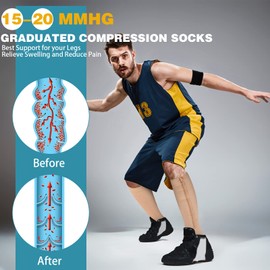 Hillban 2 Pair Plus Size Calf Zipper Compression Socks 15 to 25 Mmhg Open Toe Compression Stockings for Overweight Women Men (Nude,XL)