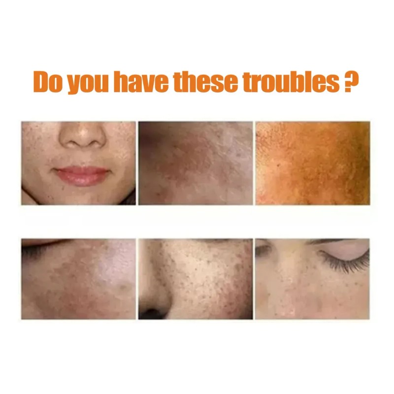 Limpiador Facial Con Cúrcuma Eelhoe Para Una Limpieza E Hidr