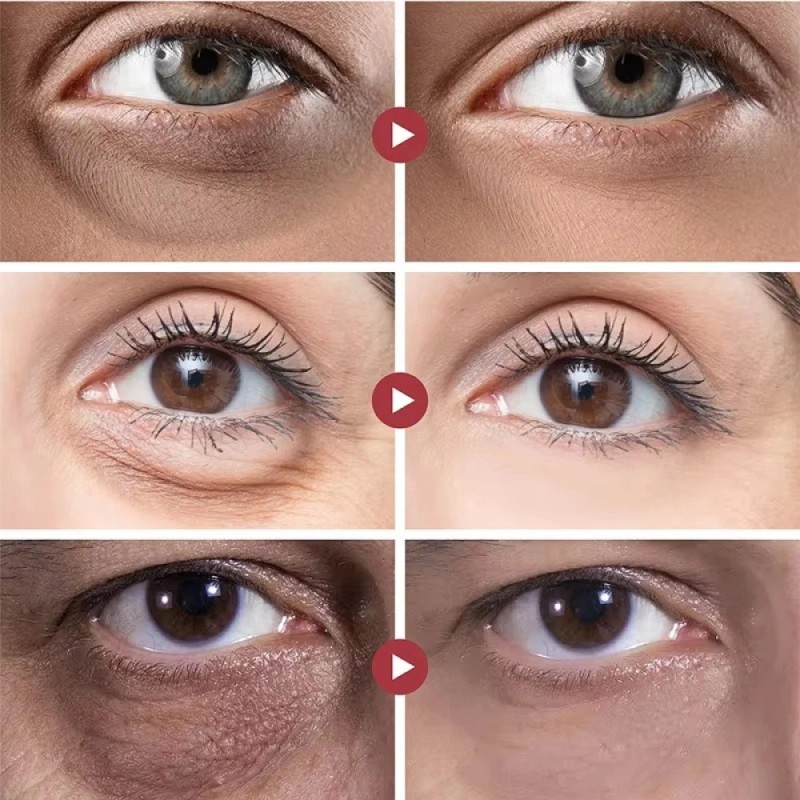 2PCS Instant Remove Dark Circles Wrinkles Face Lines Puffy Eyes