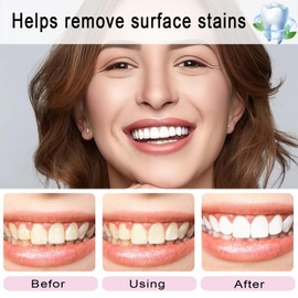 2 PCS Niacinamide Whitening Toothpaste, Intensive Whitening Toothpastes, Deep Gentle Cleaning Tooth Paste, Remove Tooth Stains, Freshening Breath, Niacinamide Toothpastes, Boosting Gum Health