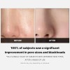 Medicube Zero Pore Pads Aha+bha Para Poros Y Acné-2ps