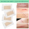 4 Pcs Elaimei Silicone Scar Sheets Stretch Marks Remover Post