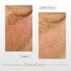Dermeden - Crema intensa para contorno de ojos antienvejecimiento, 15