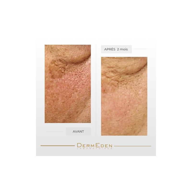 Dermeden - Crema intensa para contorno de ojos antienvejecimiento, 15