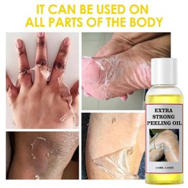Yellow Peeling Oil for Dark Skin Powerful Extra Strength Exfoliation Chemical Removal Home Body Hand Foot Knuckle All Skin Types 3.66 OZ Size / 어두운 피부를 위한 옐로우 필링 오일 강력 엑스트라 스트렝스 각질 제거 화학 제거용 홈 바디 핸드 풋 너클 모든 피부 타입 3.66 OZ Size