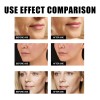 30 Ml De Cafeína Para Rostro, Antienvejecimiento Facial Para