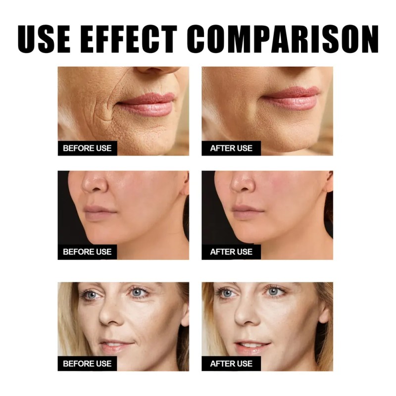 30 Ml De Cafeína Para Rostro, Antienvejecimiento Facial Para