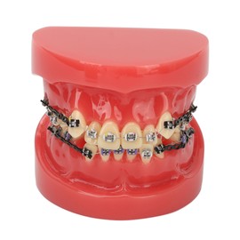 Professional Dental Demonstration Orthodontic Model with Metal Wires and Bracket for Teaching Learning